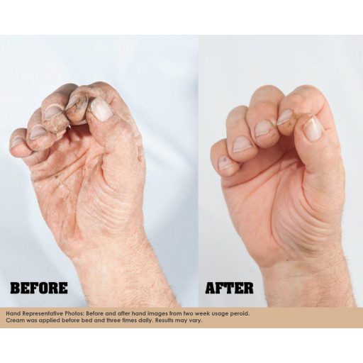 O'Keeffe's Skin Repair tubusos testápoló